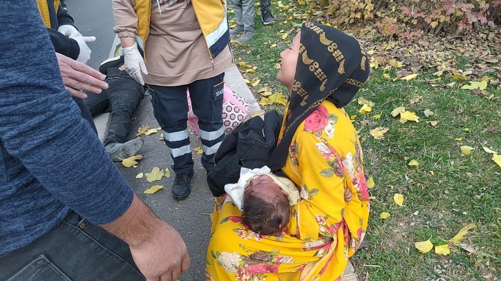 Vücudu Yanan Çocuk Hastaneye Götürülürken Kaza Geçirdi