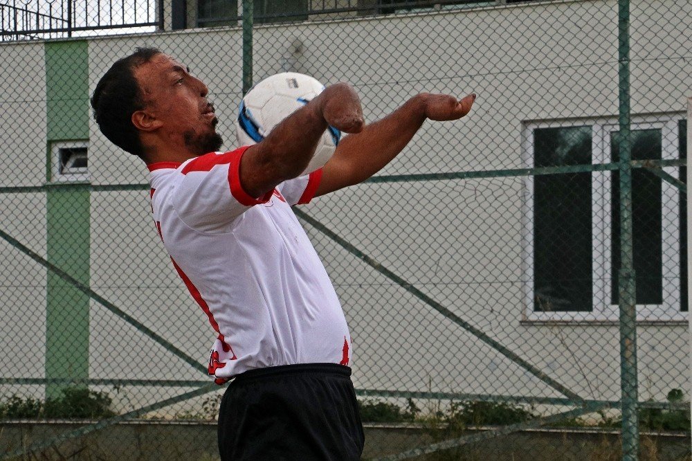 Yangında Ellerini Ve Yüzünü Kaybetti, Futbolda Gol Makinesi Oldu